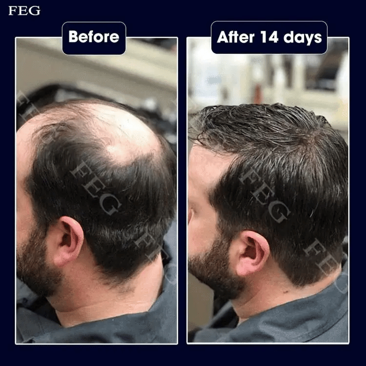 FEG PLUS Rosemary Beard Hair Growth Serum 50ml Urban Mart